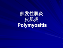 多发性肌炎医学课件