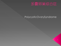 多囊卵巢综合征诊断治疗课件