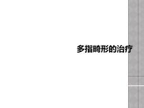 多指畸形的治疗课件