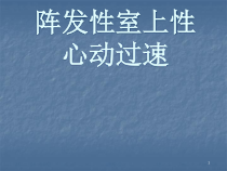 多种心动过速和wpw处理方法医学课件