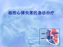 恶性心律失常的急诊治疗课件