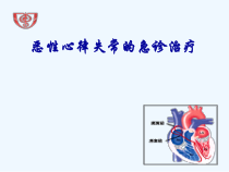 恶性心律失常急诊治疗课件