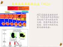 非st段抬网高acs危险评估及治疗策略课件