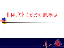 非阻塞性冠状动脉疾病医学课件