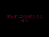 肺结核的X线表现医学影像学培训课件
