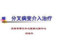 分叉病变介入治疗我的-课件