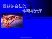 冠脉综合征的诊断与治疗课件