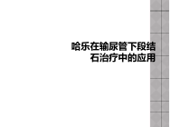 哈乐在输尿管下段结石治疗中的应用课件