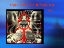 后循环主要分支闭塞的临床表现课件