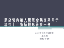 覆膜金属支架治疗CDF幻灯课件