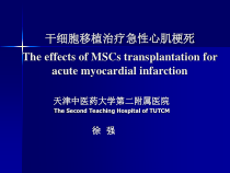 干细胞移植治疗急性心肌梗死_课件
