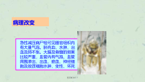 高压氧治疗下课件