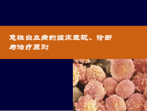 急性白血病的诊断与治疗医学课件
