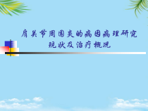 肩关节周围炎的病因病理研究现状及治疗概况年课件