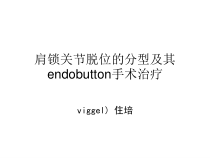 肩锁关节脱位的分型及其手术治疗课件