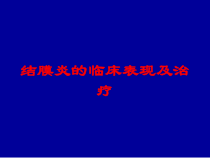 结膜炎的临床表现及治疗培训课件