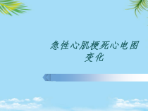 急性心肌梗死心电图变化_基础医学_医药卫生_专业全面版课件