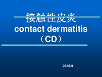 接触性皮炎的治疗进展教学课件
