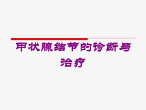 甲状腺结节的诊断与治疗培训课件