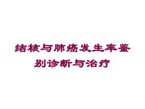 结核与肺癌发生率鉴别诊断与治疗培训课件
