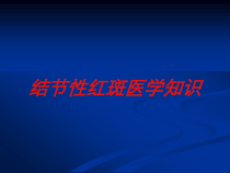 结节性红斑医学知识培训课件