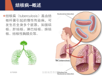结核病营养治疗培训课件