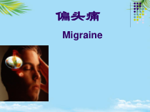偏头痛医学课件