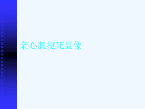 亲心肌梗死显像核医学总论课件