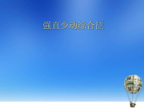 强直少动综合征医学课件