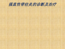 强直性脊柱炎的诊断与治疗课件