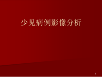 少见病影像分析医学课件
