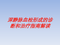 深静脉血栓形成的诊断和治疗指南解读培训课件