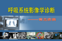 推荐医学影像诊断课件详解完整版-呼吸系统影像学