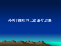 外周细胞淋巴瘤治疗进展课件