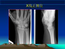 腕关节MR医学宣教课件