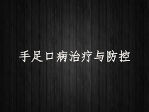 手足口病治疗与防控-课件