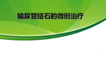 输尿管结石的微创治疗课件