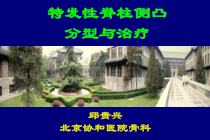 特发脊柱侧凸分型与治疗参考课件