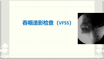 吞咽造影检查VFSS医学课件