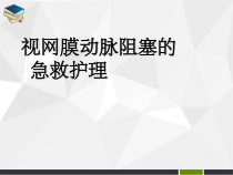 视网膜动脉阻塞的急救与护理修改医学课件