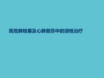 授课用_高危肺栓塞及心肺复苏中的溶栓治疗课件