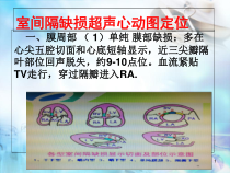 室间隔缺损医学课件