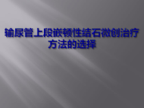 输尿管上段嵌顿性结石微创治疗方法的选择课件