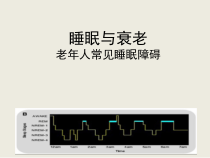 睡眠与衰老医学课件