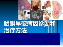 胎膜早破病因诊断和治疗方法课件