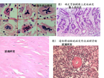 泰山医学院病理切片考试课件