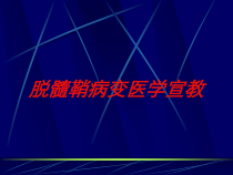 脱髓鞘病变医学宣教培训课件