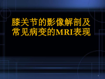 膝关节的影像解剖及常见病变的MRI表现医学课件