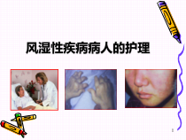 系统性红斑狼疮-SLE医学课件