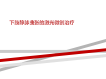 下肢静脉曲张的激光微创治疗课件